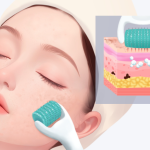 韓國KSY皮膚科麗珠蘭價格大公開！中韓同價+透明收費，變美不花冤枉錢